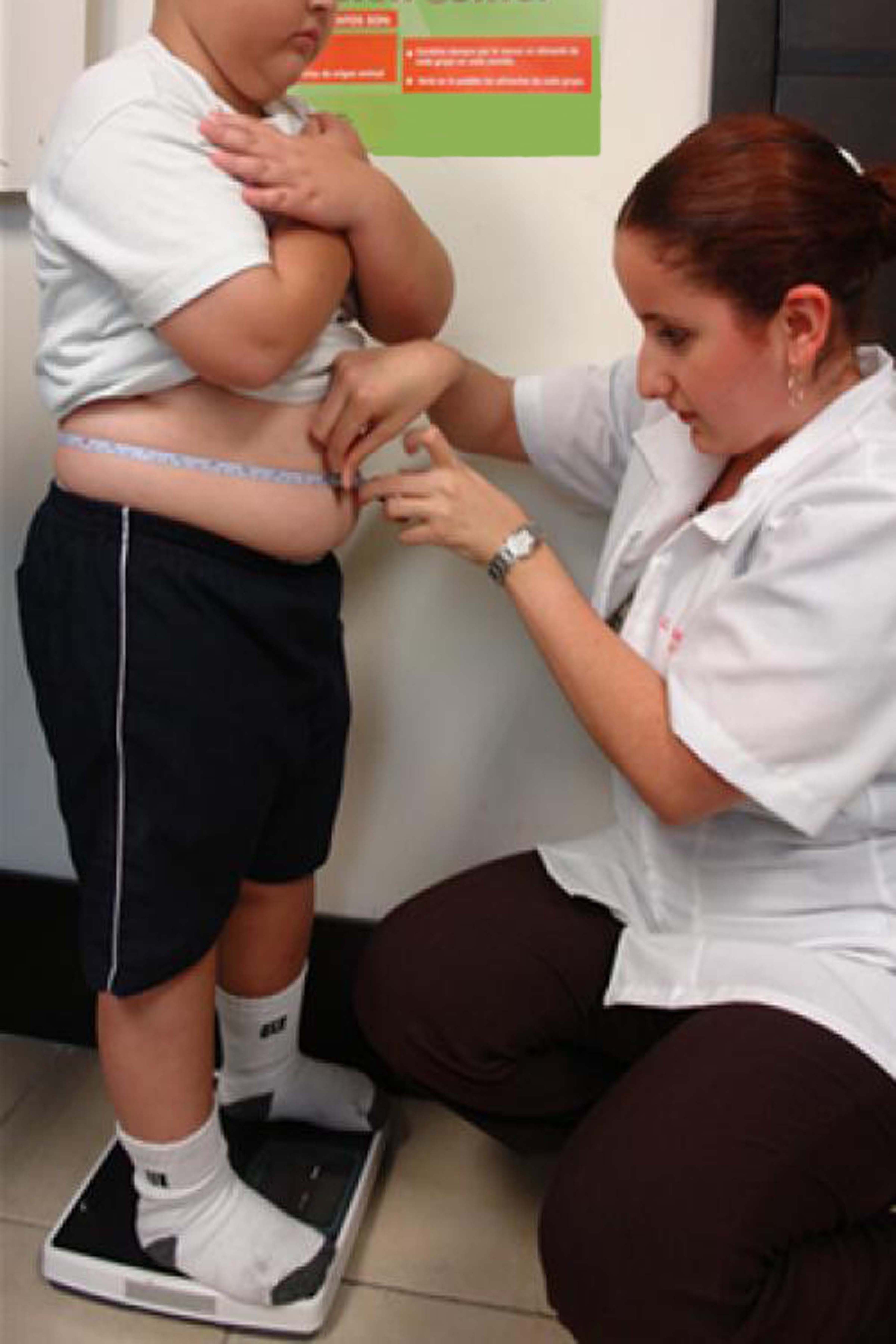 SOBREPESO Y OBESIDAD DAÑAN LA COLUMNA, ADVIERTE IMSS.