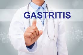 Gastritis: Causas y factores de riesgo