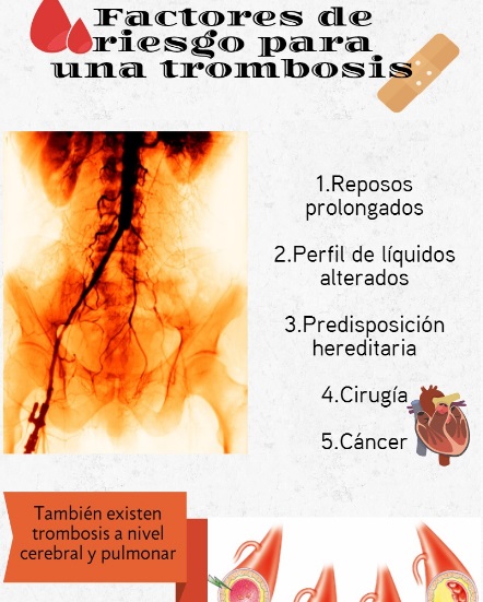 trombosis