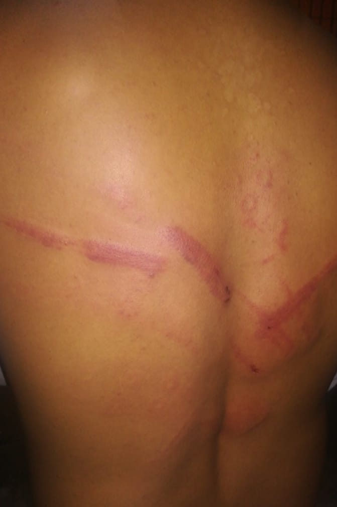 LAS (F.S.P.E) SIGUEN SUMANDO DENUNCIAS CIUDADANAS POR ABUSO DE AUTORIDAD