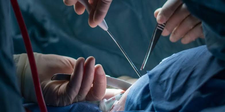 #Salud LO QUE DEBES SABER DE LA VASECTOMÍA SIN BISTURÍ