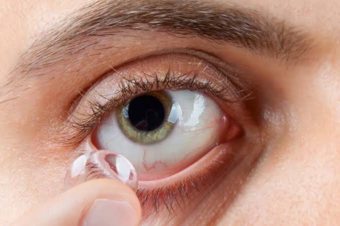 #Salud ¿POR QUÉ NO DORMIR CON LENTES DE CONTACTO?