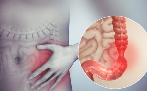 #Salud SÍNDROME DEL INTESTINO IRRITABLE (SII): SÍNTOMAS, CAUSAS Y TRATAMIENTOS