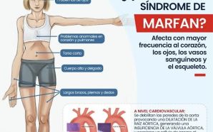 #Salud SÍNDROME DE MARFAN: EL DESAFÍO INVISIBLE QUE PONE EN…