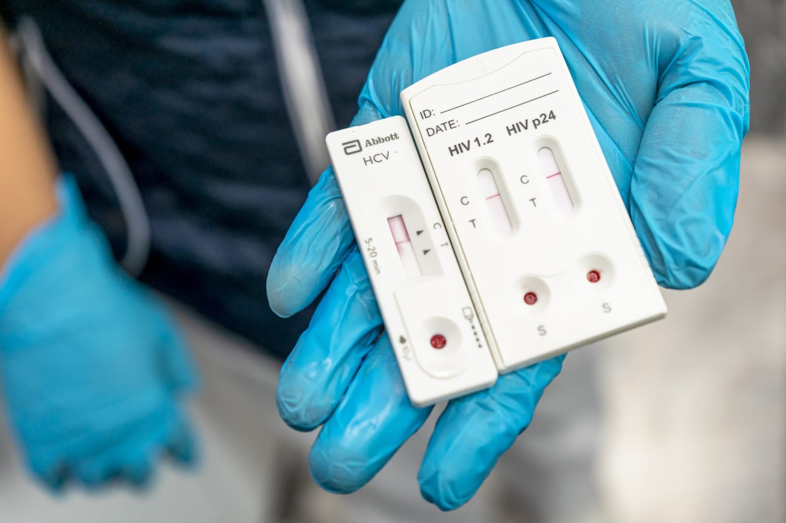 Aumentan pruebas de detección de VIH en #Salamanca